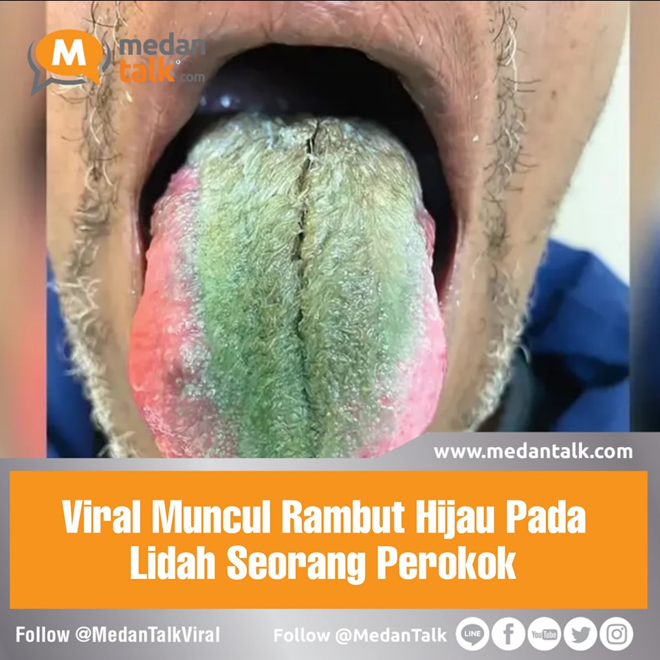 Lidah merupakan salah satu organ penting dalam sistem pencernaan manusia. Lidah dapat