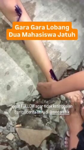Dua Mahasiswa Jatuh Dari Sepeda Motor Gara gara Lobang Dijalanan Medan ini... siapa pernah lewat sini?
Menurut pengirim video: “krononologis kejadian kepada 2 orang mahasiswa jatuh dari kereta dikarenakan lobang yang besar di jalan veteran helvetia pasar 4 Medan sekitar jam 22.30 WIB, 16/10/25. Kejadian karena posisi pengendara/ korban dibelakang mobil dan tidak nampak ada lobang besar dan lampu jalan yang mati sepanjang jalan veteran helvetia. Dimohon untuk para pemerintah kota Medan untuk memperbaiki jalan di sepanjang jalan veteran helvetia dari pasar 4 hingga pasar 10 helvetia dan lampu jalan yang mati itu membahayakan pengendara untuk berlalu lalang di daerah tersebut sudah banyak sekali orang yang berkeluh kesah dan hampir jatuh karena jalan yang berlubang besar”
Masyarakat dihimbau untuk berhati-hati di jalan tersebut
♡ Silakan share (cerita/info lalulintas) ke story mention @medantalk dan juga @medantalkviral @medanku @medantalkid utk admin seleksi dan repost. Ingat tulis lokasi & kapan kejadian, keterangan kejadian dgn jelas dan lengkap di story agar mudah di mengerti saat repost. Pastikan juga akun anda tidak dikunci agar kami bisa lihat dan repost. Terima kasih
◇ Selalu pantau STORY dan FOLLOW @medantalk utk info kejadian/kecelakaan/lalulintas terkini yang blm tentu di post ke feed. Ingat juga Aktifkan notifikasi agar tidak ketinggalan breaking news/story